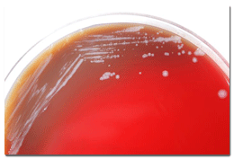 Gram-negative Burkholderia mallei bacteria, which was grown on a medium of sheep’s blood agar